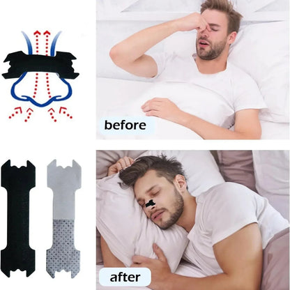 Nasal Strips - FacialGrow