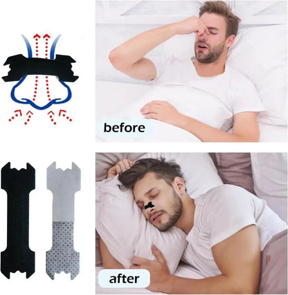 Nasal Strips - FacialGrow